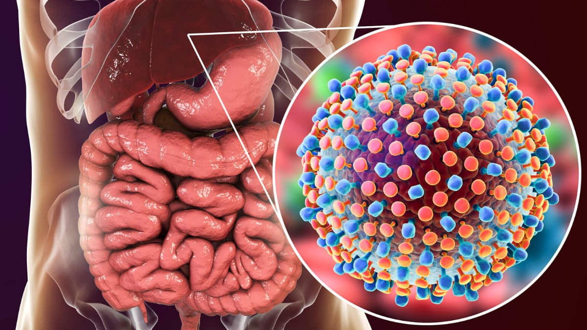 Çfarë Është Hepatiti D? – Informacionet e Rëndësishme që Duhet t’i Dini