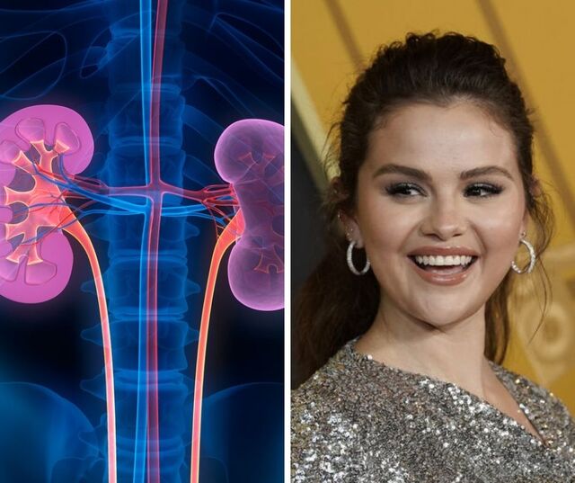 Sëmundja që ndryshoi jetën e Selena Gomez… Çfarë është Lupus?