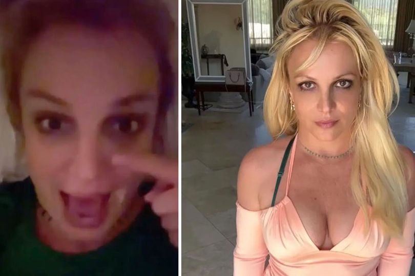 Tentoi të ndizte zjarrin, Britney Spears-it i digjen qerpikët dhe vetullat