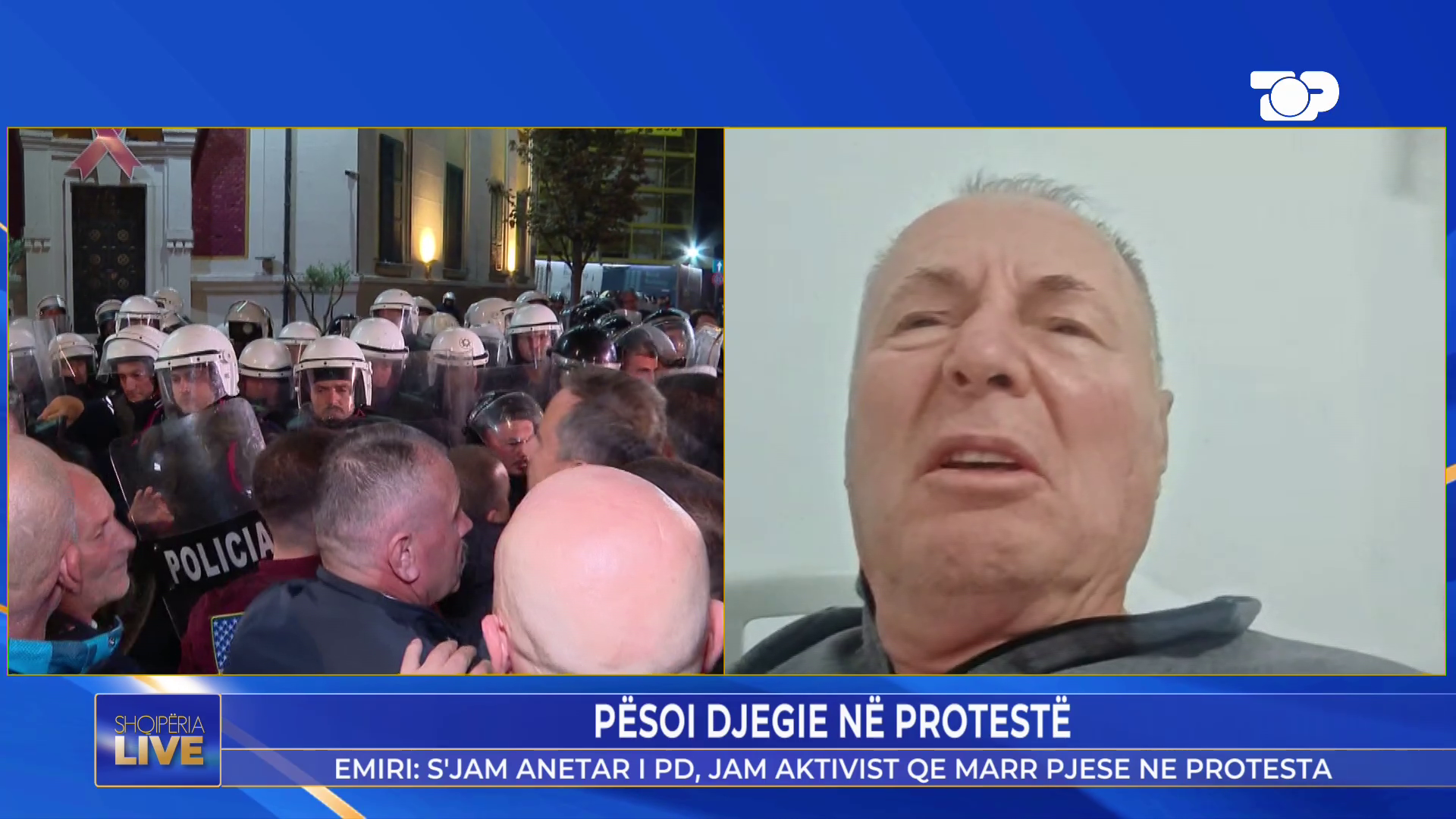 “Kam djegie të gradës së tretë”/ Flet qytetari që u dëmtua nga molotovi dje në protestë: Efektivi i ra me shqelm dhe e hodhi…