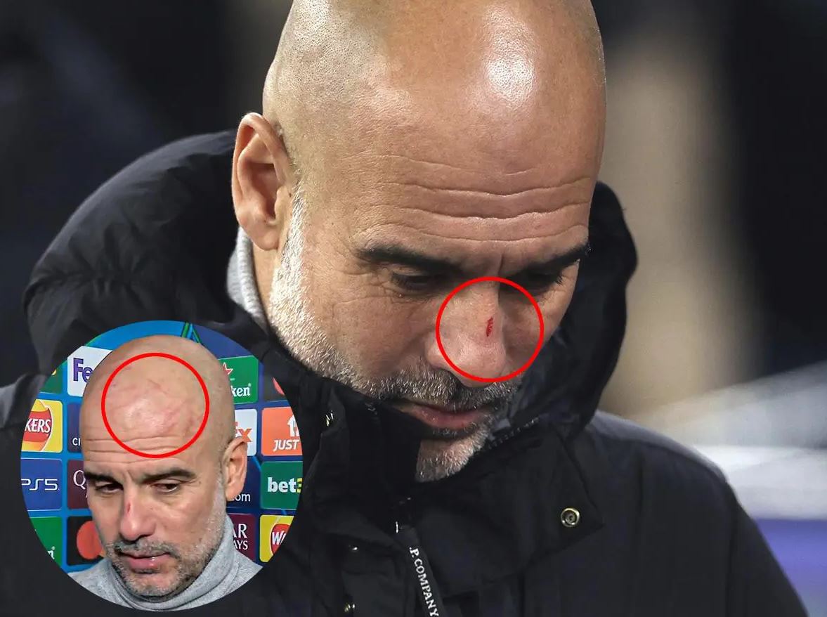 U shfaq i gjakosur pas Feyenoord, shokon Guardiola: Doja t’i bëja keq vetes (VIDEO)